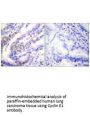 CCNE1 Antibody