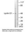 CCNE1 Antibody
