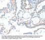 TLR2 Antibody