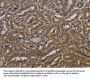 KCNK17 Antibody