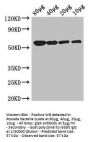 glpK Antibody