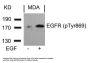 Phospho-EGFR (Tyr869) Antibody