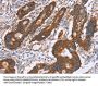 PDLIM1 Antibody