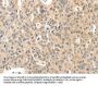 ROS1 Antibody