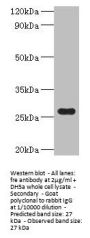 Rabbit anti-Escherichia coli NAD(P)H-flavin reductase polyclonal Antibody