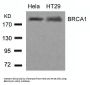BRCA1 (Ab-1423) Antibody