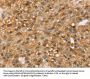 MED22 Antibody