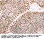 ABHD12 Antibody