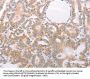 ABHD12 Antibody