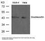 DCX Antibody