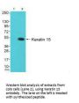 KRT15 Antibody