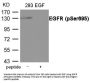 Phospho-EGFR (Ser695) Antibody