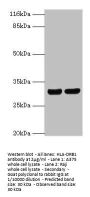 HLA-DRB1 Antibody