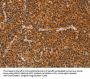 IKZF3 Antibody