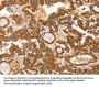 IKZF3 Antibody