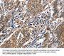 ALOX15 Antibody