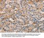 ALOX15 Antibody