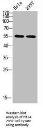 TUBA1A/TUBA1B/TUBA1C/TUBA3C/TUBA8/TUBA4A Antibody