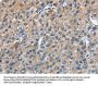 TRIP4 Antibody