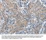 TRIP4 Antibody