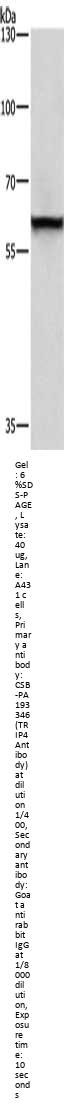 TRIP4 Antibody