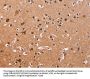 CSNK1D Antibody