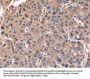 CSNK1D Antibody