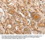 Rabbit anti-human CDKN1C polyclonal antibody