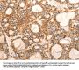 Rabbit anti-human CDKN1C polyclonal antibody