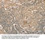 PIK3CD Antibody