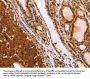 SLC9A3R2 Antibody