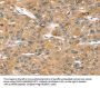 SORT1 Antibody