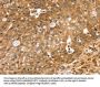 SORT1 Antibody