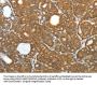 PRDX3 Antibody