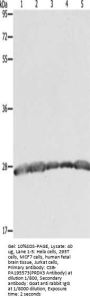PRDX3 Antibody