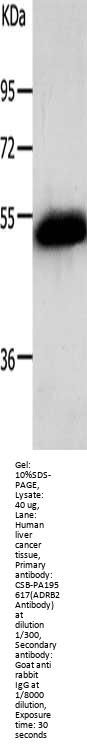 ADRB2 Antibody