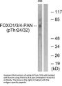 Phospho-FOXO1/FOXO3/FOXO4 (Thr24/32) Antibody