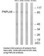 PNPLA8 Antibody