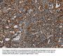 NDUFS3 Antibody