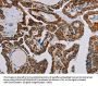 NDUFS3 Antibody