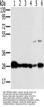 NDUFS3 Antibody