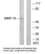 MMP19 Antibody
