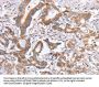 ITGB5 Antibody