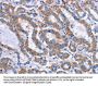 ITGB5 Antibody
