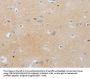 MMP25 Antibody