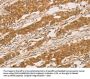 SLC6A3 Antibody