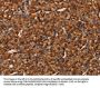 COL18A1 Antibody