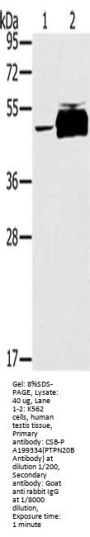 PTPN20A; Antibody