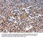 HSPD1 Antibody