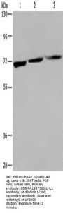 Rabbit anti-human KLHL1 polyclonal antibody